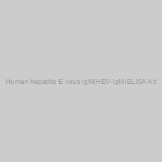 Image of Human hepatitis E virus IgM(HEV-IgM)ELISA Kit